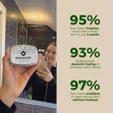 Rosemary Glow Soap For Hyperpigmentation & Dark Spots